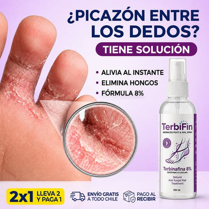 TerbiFin® — Tratamiento Antihongos de Acción Rápida (8%)