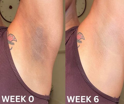 Dr. Melaxin Tratamiento Aclarante de Piel
